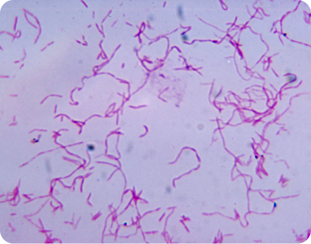 Inflammatory Bowel Disease