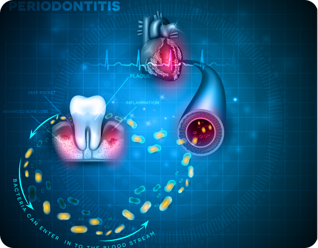 Cardiovascular Disease