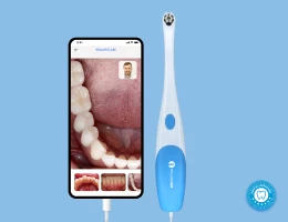 Wired Intraoral Camera | MouthCAM | Dentulu