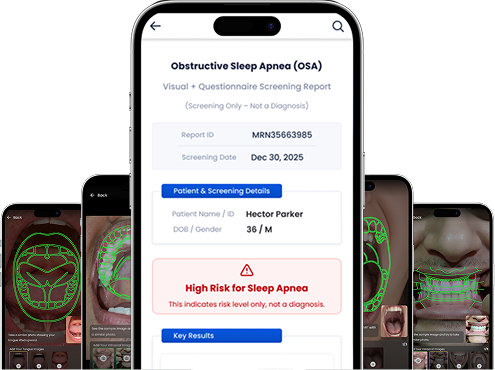 Mobile app showing AI powered obstructive sleep apnea screening results and risk assessment