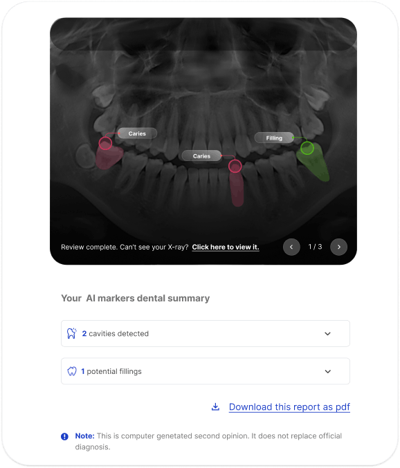 Dental X-ray AI analysis with highlighted findings