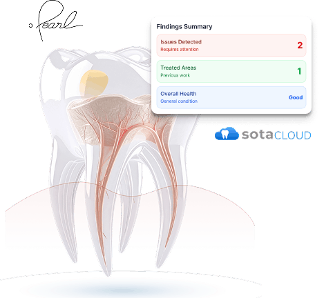 AI Caries Detection Tooth Visualization