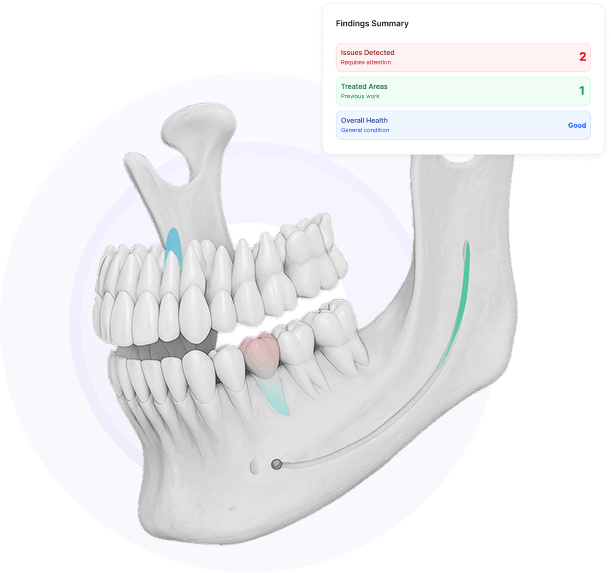 3D dental jaw model with highlighted AI detected areas and findings summary overlay