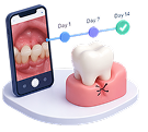 Post procedure monitoring with dental images on smartphone