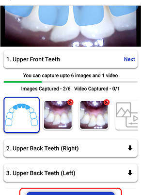 Capturing intraoral images using mobile app