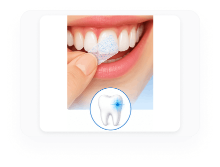 Applying CrystLCare strip to tooth surface
