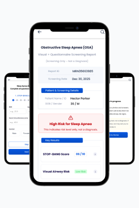 AI sleep screening mobile application
