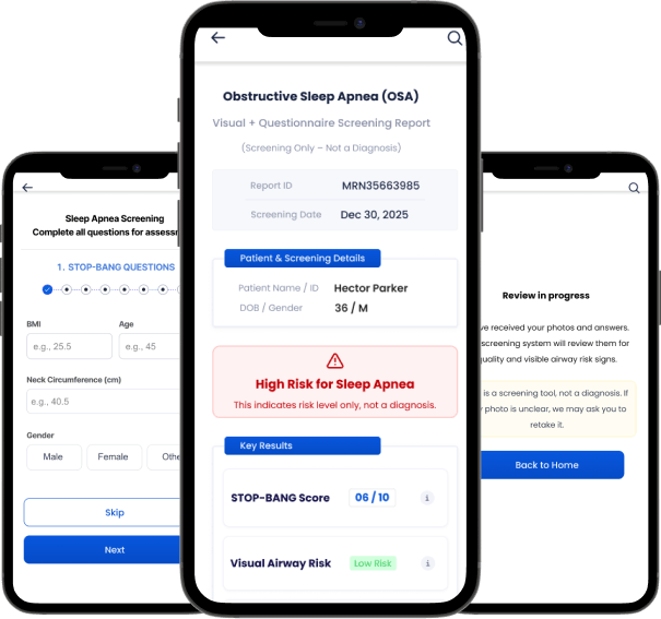 AI-powered screening mobile interface showing sleep apnea risk assessment