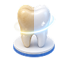 Teeth whitening dental model