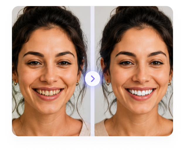 AI smile design before and after transformation preview