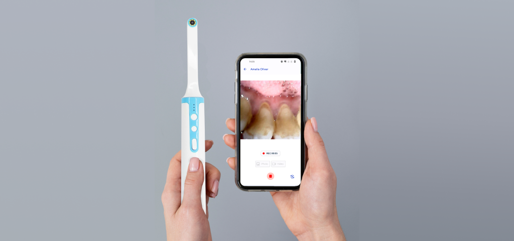 8 Things to Consider Before Selecting an Intraoral Camera